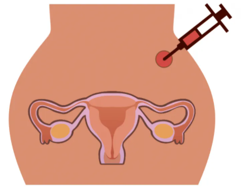 国内供卵代生医院,试管婴儿长大后常见弊端也许跟你想象中不同