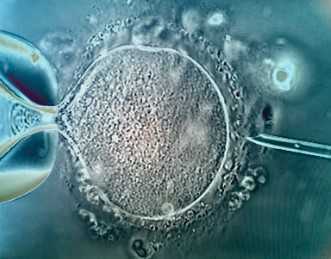 国内供卵哪里可以,汕头试管婴儿早产的症状有哪些