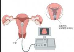 全国有哪些供卵医院排名,狼疮抗凝物偏高影响胚胎着床吗？