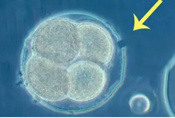 国内供卵机构有哪些公司,卵子先排出等精子怀孕几率大吗，排卵期是等排出来再同房怀孕几率高吗