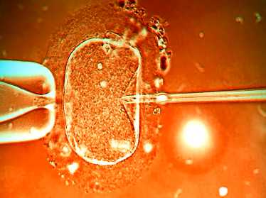 国内代生孩子服务,叶海洋买精生的女儿是哪5国混血？