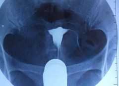 国内代怀花费,吸奶器多久吸一次比较好(如何使用吸奶器正确追奶)