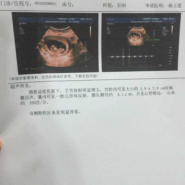 国内供卵代怀双胞胎案例,健康科普：降低体脂率的8个方法，学到受用一*
